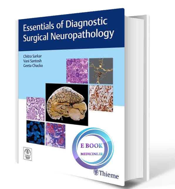 دانلود کتاب  Essentials of Diagnostic Surgical Neuropathology: Care of the Adult Neurosurgical Patient  (ORIGINAL PDF)